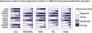 Differential diagnosis of CD5+ B-lymphoproliferative disorders. Expression pattern of Key diagnostic markers in different CD5+ B-lymphoproliferative disorders. CLL, Chronic lymphocytic leukemia; WM, Waldenström’s Macroglobulinemia; MZL, Marginal Zone B-cell Non-Hodgkins Lymphoma; MCL, Mantle cell lymphoma; FCL, Follicle center lymphoma; DLBL, Diffuse Large B-Cell Lymphoma.
