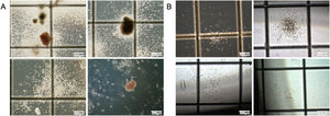 Colony formation assay of differentiated cells. iPSC_scd cells previously cultured in (A) SFM and collected from embryoid bodies on day 8 of differentiation, (40× and 100× magnification); and in (B) STEMdiff APEL 2 medium collected from embryoid bodies on day 8 of hematopoietic differentiation (40× magnification).