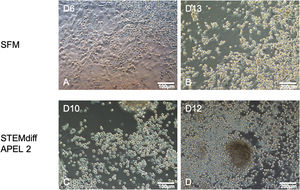 Culture of iPSC_scd cells in the maturation medium at various points of time. Presence of many semi-adhered rounded cells during maturation of cells previously cultured in SFM (A–B) and in STEMdiff APEL 2 medium (C–D) was observed (A and C, 200× magnification; B and D, 100× magnification).