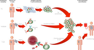 Basic principles of adoptive cell therapy, IL-2.interleukin-2, TIL (tumor-infiltrating lymphocytes), CAR (chimeric antigen receptors), TCR (T-cell receptor), APC (antigen-presenting cell), PBL (peripheral blood lymphocytes), antibody.