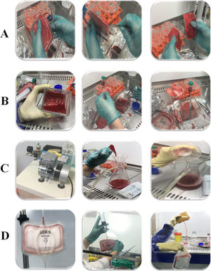 The schema of the LRF’s structure and the applied isolation procedures, as described in detail in the materials and methods section. The LCR5 Macopharma leukoreduction Filter structure (A) and applied PBMNCs isolation methods: direct (B), vacuum pump and (C) back-flushing (D).
