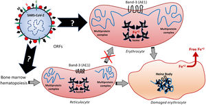 Hypothetical mechanisms underlying the SARS-CoV-2-induced formation of Heinz Bodies as a clinical sign of hematological alteration that may occur through two possible routes, as represented by black arrows. The SARS-CoV-2 infection may affect the membrane Band-3-anchored multiprotein complex, thus resulting in erythrocyte damages. Furthermore, the SARS-CoV-2 infection may interfere with the early hematopoiesis processes in the bone marrow, resulting in the production and release of immature erythrocytes, the so-called reticulocytes. Therefore, this red blood cell maturation would be impaired by the viral infection, thus reducing the chances of producing a healthy erythrocyte, which may culminate in either reticulocyte death or its bizarre morphophysiological maturation.