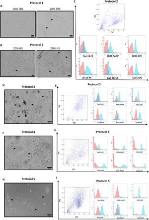 Morphology and purity analysis of murine BM-MSCs cultured according to different protocols. (A) Cells cultured according to protocol 1 after 21 days of plating. Cells cultured with 10% FBS were rounder and smaller, compared with cells cultured with 20% FBS, which were more elongated, arranged in groups and presented more protrusions (arrows). These cells did not reach the necessary confluency to be analyzed by flow cytometry. (B) Cells cultured according to protocol 2 after 10 days of culture with 10% HS or 20% HS supplementation. Observe that the cultures containing 20% HS presented more elongated cells with a fibroblastic-like cell shape (arrows) and higher confluency, whereas the 10% HS condition generated fewer cells, of which most were round and dark indicating unviability (arrows). (C) The panel of cell surface markers consisted of antibodies anti-Ter119, anti-CD45, anti-CD31, anti-CD11b, anti-Sca1 and anti-CD44. The red histogram represents control cells and the blue histogram represents the cells incubated with the indicated antibodies. Cells cultured according to protocol 2 were positive for CD45, CD31, CD11b, Sca1 and CD44 and negative for Ter119. (D) Cells cultured under protocol 3 after 7 days in culture. Cells presented either an elongated shape (arrows) and were spread in the flask or exhibited a dark rounded shape organized in clusters. (E) Expression of the differentiation markers was similar to protocol 2. (F) Cells after 7 days of culture performed according to protocol 4, showing adherent cells with a slightly elongated shape (arrows) coexisting in the same flask with non-adherent cells (shadows of the cells floating in the media). (G) Cells cultured following this protocol were positive for all surface markers. (H) Cells cultured according to protocol 5 after 25 days of plating, showing a few small round cells spread in the flask and some spindle-shaped cells (arrows) organized in clusters and forming a monolayer (phase contrast image). (I) Similar to protocols 2 and 3, cells cultured according to protocol 5 were also positive for CD31, CD11b, Sca1 and CD44 and CD45 and negative for Ter119.