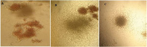 The proliferation of total cells and CD133+ cells. a) TNC cultured in TCP generated 45-fold expansion, while it expanded 65-fold in the microfluidic system (p < 0.05). b) CD133+ cells yielded hematopoietic colonies after 12 days of culture in methylcellulose containing CFU-E, CFU-GEMM and CFU-GM in a microfluidic system (* p < 0.05)