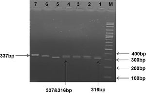 Gel electrophoresis picture showing RFLP analysis of FCGR2A gene polymorphisms. Lane 1: DNA marker (100–1500 bps). Lanes 1 and 5 show mutant FCGR2A homozygous genotype R/R (316 bp). Lanes 2, 3 and 4 show heterozygous H/R FCGR2A genotype (337, 316 bp). Lanes 6 and 7 show wild FCGR2A genotype H/H (337 bp).