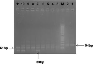 Gel electrophoresis picture showing RFLP analysis of FCGR3A gene polymorphisms. Lanes 1 and 2 show wild FCGR3A genotype F/F (94 bp), Lane M: DNA marker (50–1000 bps). Lanes 3, 8, 9 and 11 show mutant FCGR3A homozygous genotype V/V (61 and 33 bp). Lanes 4, 5, 6, 7 and 10 show heterozygous F/V FCGR3A genotype (94, 61 and 33 bp).