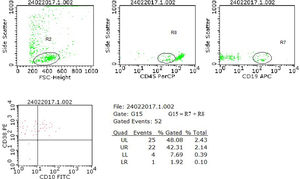 Analysis model of neoplastic cell research in cerebrospinal fluid (CSF) samples using flow cytometry. The case illustrated refers to a diagnosis of B-ALL from our series, with the immunophenotype CD45+weak, CD10+, CD19+ and CD38+, which presented, in a CSF sample collected in the D15 of chemotherapy treatment, a zero nucleated/µL cell count, negative research of blasts by cytomorphology and positive result for the presence of blasts by flow cytometry. In the flow cytometry analysis, the neoplastic precursor cells were initially selected by the physical characteristics (R2), the CD45+weak expression (R8) and the CD19 lineage marker (R7). The expression of the aberrant markers CD10 and CD38 was evaluated in the G15 region, formed by the combination of R7 + R8. The finding of a cluster of 22 cells with the same phenotypic profile characterized at diagnosis defined the positive result for examining neoplastic cells in this sample.