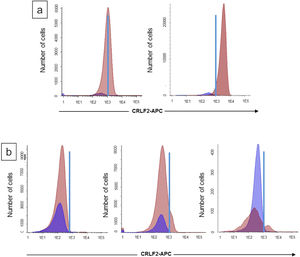 Main profiles of CRLF2 antigen expression in BCP-ALL blast cells. (a) Representative histograms of CRLF2 positive cases (≥ 10%): moderately positive expression (left) and strongly positive expression (right). (b) Representative histograms of CRLF2-negative cases (< 10%): completely negative curve (left), subclones with a shift to the right curve (middle) or a clear peak definition (right). The pink curves represent leukemic blasts; the blue curves represent the lymphocytes, used as negative controls.