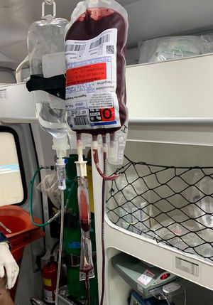 Red blood cell concentrate that was transfused to the patient.