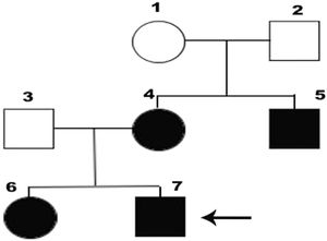 Family tree of the patient and his family.