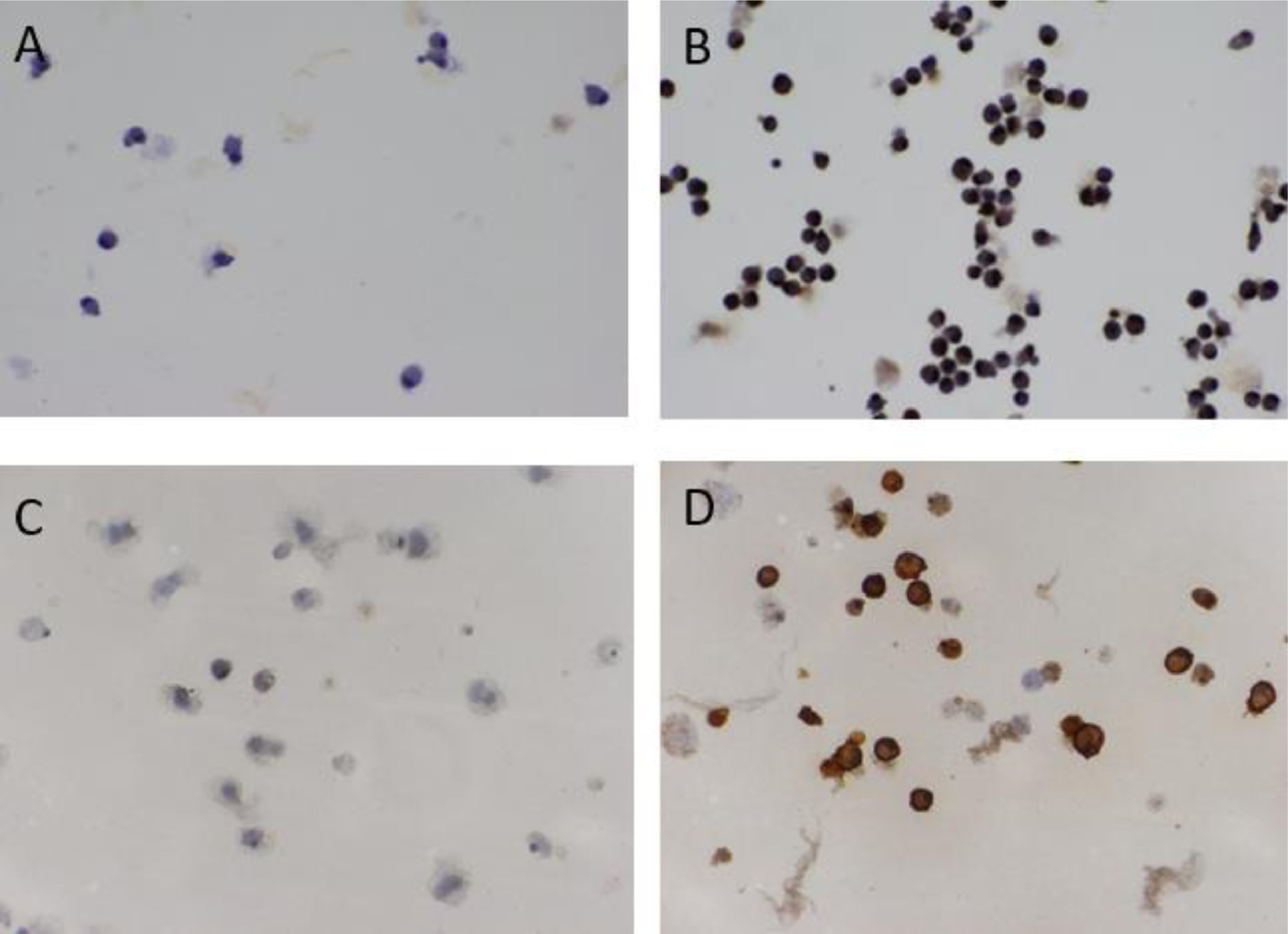 Production of dendritic cell vaccines using different methods with  equivalent results: Implications for emerging centers | Hematology,  Transfusion and Cell Therapy
