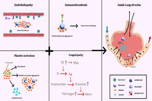 Overview of main factors involved in immunothrombosis due to COVID-19. Increased von Willebrand factor (VWF) released by endothelial cells and platelets recruit leukocytes during inflammation. The P-selectin enables the recruitment of platelets and more leukocytes and induces monocyte TF expression. The TF, in turn, stimulates the activation of the coagulation