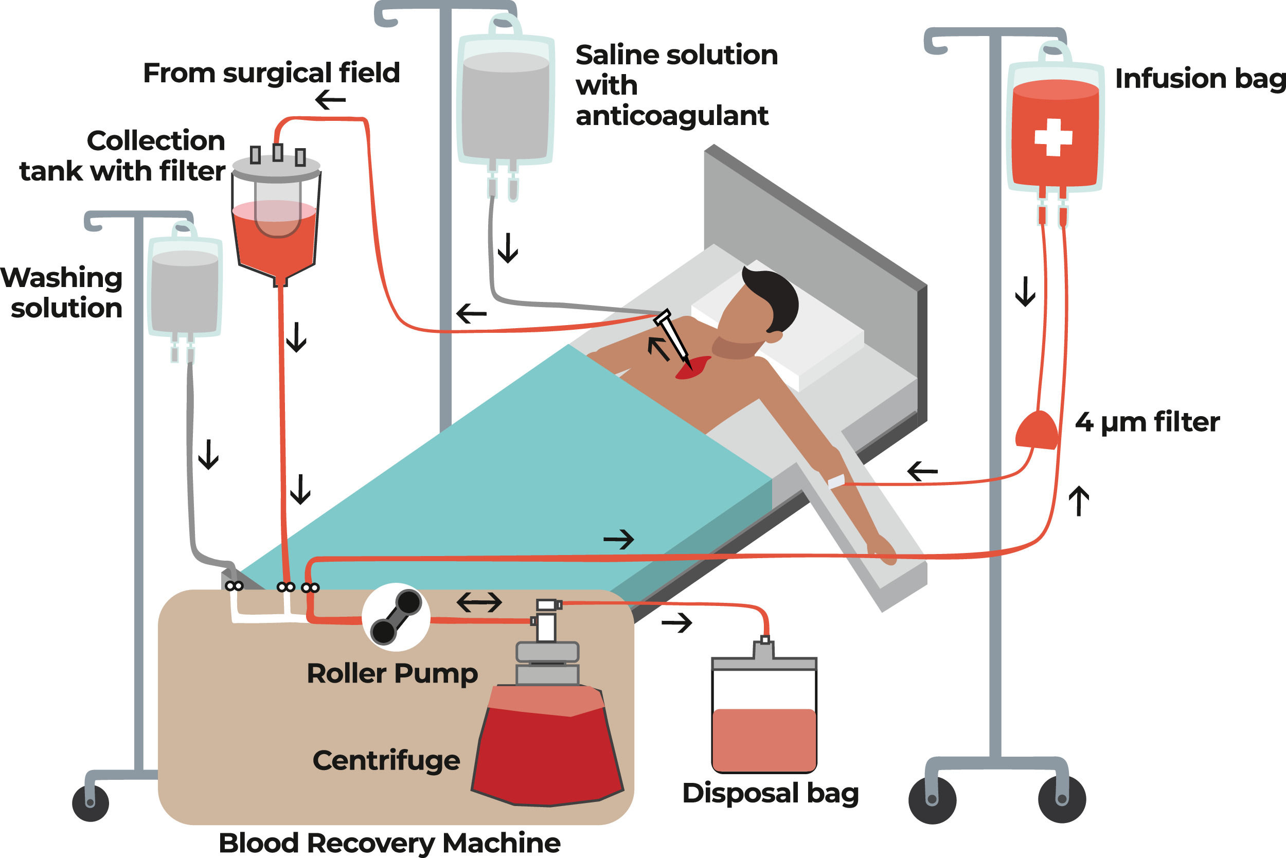 Consensus of the Brazilian association of hematology, hemotherapy and ...