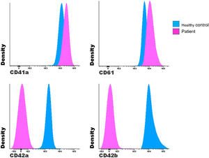 Comparison of the MFI between a patient with suspected Bernard-Soulier and a healthy control.