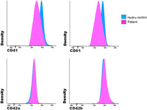 Comparison of the MFI between a patient with suspected GT and a healthy control.