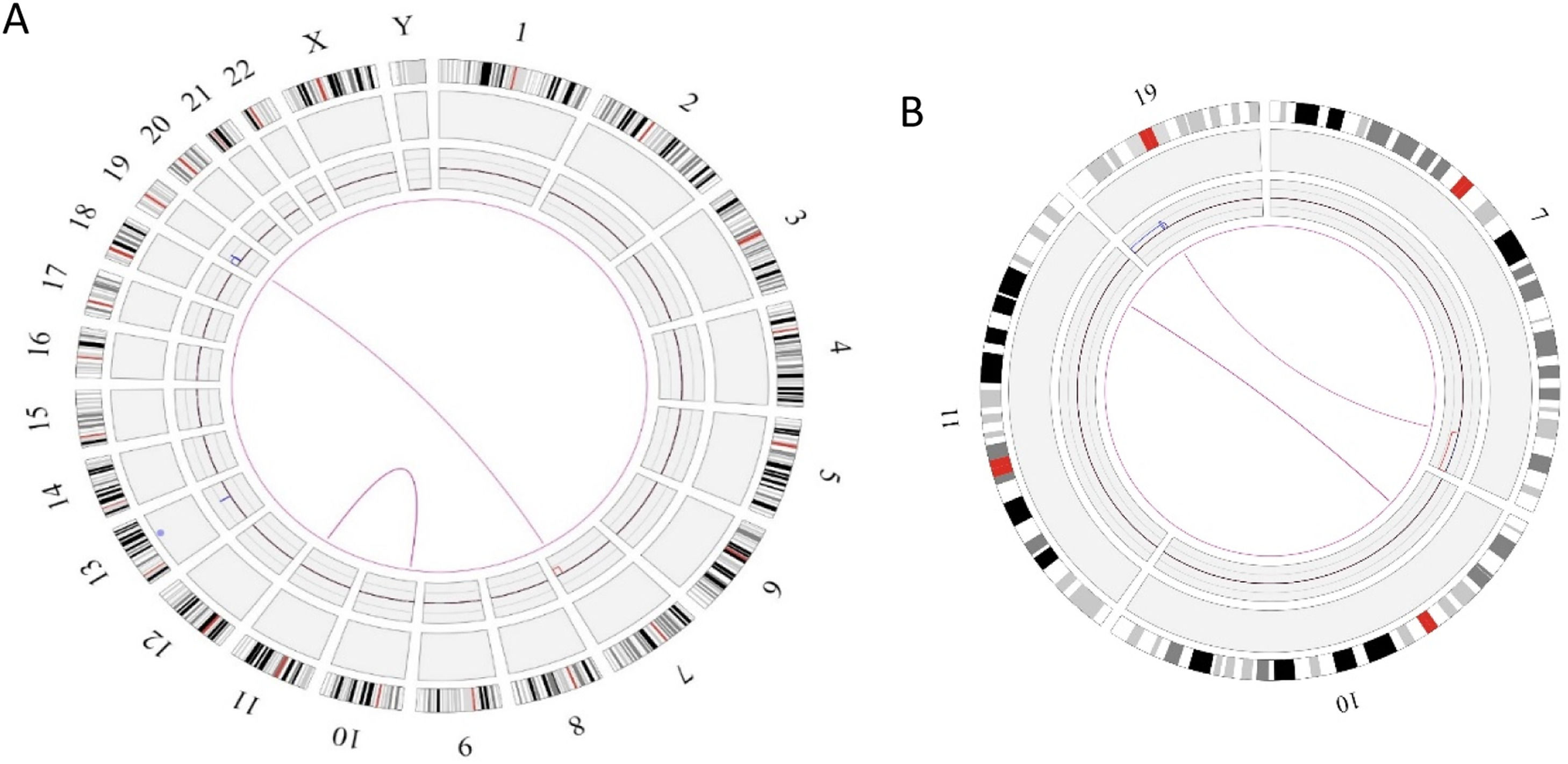Optical genome mapping identifies hidden structural variation in acute ...