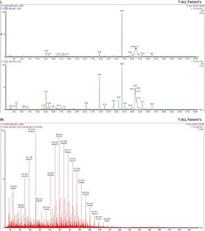 Label-free screening of differential proteins in T-ALL by using liquid chromatography-tandem mass spectrometry (LC-MS/MS). (A) shows the integrity of proteins isolated from healthy controls and T-ALL patients (Lanes 1–4 show healthy controls, and Lanes 5–9 show T-ALL patients), whereas (B-I) shows protein estimation, which was analyzed by the bicinchoninic acid kit. (J-M) shows the LC-MS/MS spectra of healthy controls and T-ALL patients. (N-P) shows 35 differentially expressed proteins in healthy controls and T-ALL patients, whereas the heatmap also shows the overall cumulative differential expression of proteins expressed in both groups. (Q) Nine signature proteins were found only in T-ALL patients and not in healthy controls.