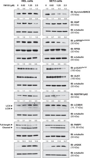 YM155 induces autophagy, apoptosis, and DNA damage markers in JAK2V617F cells. Western blot analysis for survivin/BIRC5, XIAP, phospho(p)-ribosomal protein S6 (RPS6), RPS6, p-ULK1, ULK1, SQSTM1/p62, LC3BI/II, PARP1 (total and cleaved), and γH2AX in total extracts from HEL and SET2 cells treated with a vehicle or with increasing doses of YM155 (0.62, 1.25, and 2.5 µM) for 24 h. Membranes were re-incubated with α-tubulin antibody and developed with the SuperSignal™ West Dura Extended Duration Substrate system and GBox. Relative quantification was performed using band intensities determined by UN-SCAN-IT gel 6.1 software. The expression of XIAP, survivin/BIRC5, SQSTM1/p62, and γH2AX was normalized by α-tubulin. Ratios for p-RPS6/RPS6, p-ULK1/ULK1, LC3BII/LCBI, and cleaved PARP1/full-length PARP1 are also described.