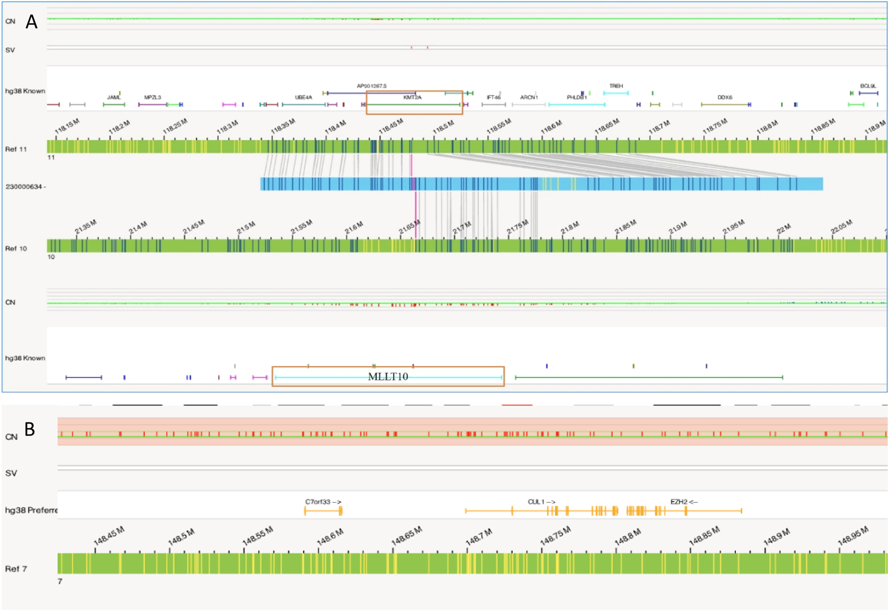 Optical genome mapping identifies hidden structural variation in acute ...