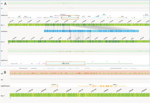 Structural variant view in which optical genome mapping in Case 1 reveals; a) gene fusions detected with translocations between chromosomes 10 and 11: KMT2A:MLLT10, b) Deletion of the EZH2 gene in chromosome 7.