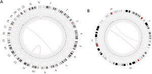 Circos plot showing the structural variants (SVs) in Case 1. a) Optical genome mapping helped to find the clinically relevant unbalanced translocation event between chromosomes 7 and 19, which resulted in copy number variation loss in chromosome 7 and a balanced rearrangement event between chromosomes 10 and 11. b) Enlarged SV view of the chromosome that has relevant SVs.