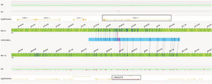Showing the structural variant view in which optical genome mapping in Case 2 identified the translocation between chromosomes 21 and 16 resulting in the CBFA2T3::RUNX1 gene fusion.