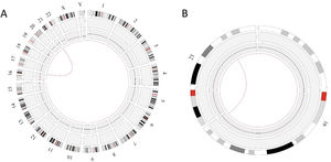Circos plot summarizing the structural variant event in Case 2 a) the interchromosomal translocation between chromosomes 16 and 21, b) enlarged structural variant (SV) view of the chromosome with relevant SVs.