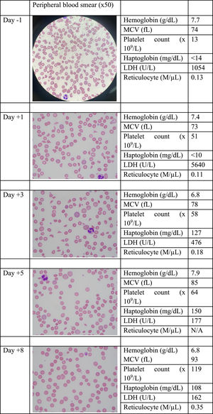 Days on plasmapheresis and changes in blood smears (x50), blood counts, and hemolysis parameters.