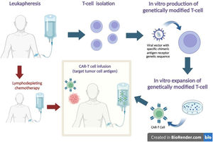 CAR-T Cell Therapy. After leukapheresis, T cells are isolated, and a tumor-specific chimeric antigen receptor is inserted into the cell surface using a viral vector. An expansion of cell mass is promoted in a culture medium. To receive genetically modified T-cells, the patient previously receives lymphodepleting chemotherapy. After infusion, CAR-T cells recognize the tumor antigen and act to promote tumor cell death.