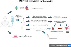 CAR-T cell associated cardiotoxicity. IL: interleukin.