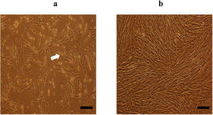 Morphological characteristics of unrestricted somatic stem cells (USSCs). (a) Spindle-shaped morphology of USSCs under an optical microscope on Day 3 with approximately 30% confluency. (b) USSCs at 80% confluency on Day 8. Both images (a) and (b) are from the Control Group (magnification 100x, scale bar = 50 µm).