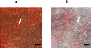Multilineage differentiation potential of unrestricted somatic stem cells (USSCs). (a) After osteogenic induction, mineralized calcium nodules were detected using Alizarin Red staining (magnification 200x) (b) After adipogenic induction, lipid droplets were visualized by Oil Red O staining (magnification 200x).