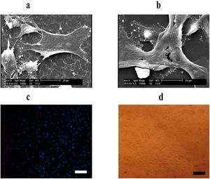 Cell attachment on fibrin. (a) Scanning electron microscopy (SEM) image of unrestricted somatic stem cells (USSCs) with fibrin. (b) SEM image of USSCs without fibrin. (c) Viable nuclei (blue) were shown using DAPI staining under a fluorescence microscopy. (d) Light microscopy image of USSCs attached to fibrin (scale bar = 50 µm).