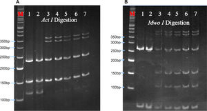 Polyacrylamide gel electrophoresis. Aberrant band pattern separation of restriction enzymes A. Aci I and B. Mwo I digested polymerase chain reaction (PCR) product on 12 % polyacrylamide gel. The gel picture showed the restriction digestion patterns of the PCR products from samples under investigation (samples 3, 4, 5, 6, and 7) and samples with known genotypes, which were used as the digestion and migration controls (samples 1 and 2). Aci I digestion produced two fragments viz. 156-bp and 236-bp, while Mwo I produced three fragments of sizes 51-bp, 67-bp and 274-bp. M: 50 bp DNA ladder (Cat. No.: DM012-R500, GeneDirex). The gels were stained with ethidium bromide (0.5μg/mL final concentration in 0.5x TBE buffer) for 15 mins with gentle shaking, followed by destaining for 20 mins with deionized water.
