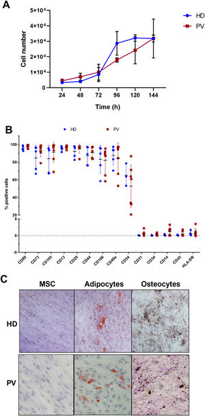 Characterization of bone marrow mesenchymal stromal cells (BM-MSC) of polycythemia vera (PV) patients and healthy donors (HD). A. BM-MSC growth curve, where data were expressed as means (PV: n = 4; HD: n = 3). B. BM-MSC immunophenotype, expressed as percentage of positive cells relative to 10,000 events. The number of the samples varied according to the marker C. Representative images of multipotential analysis. Left: BM-MSC grown in base medium (α-MEM supplemented with 10 % fetal bovine serum) and stained with hematoxylin. Center: MSC after 12 days of growth in adipogenic medium. Lipid accumulation in adipocytes (orange) stained with Sudam III and counterstained with hematoxylin. Right: MSC after 15 days of growth in osteogenic medium. Calcium deposits in osteocytes (brown) stained with von Kossa stain and counterstained with hematoxylin.