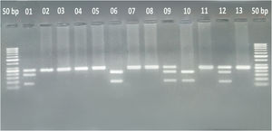 A representative gel photograph of the Polymerase Chain Reaction-Restriction Fragment Length Polymorphism assay. The gel depicts two DNA fragments in samples 6 and 10, indicating the CC genotype. Samples 1, 9, and 12 show three DNA fragments, representing the CT genotype. On the other hand, the remaining samples exhibit a single DNA fragment, indicating the TT genotype.