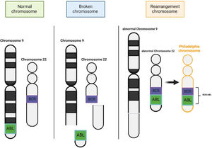 Schematic representation of the t(9;22)(q34;q11) translocation, which facilitates the formation of the Philadelphia chromosome. The ABL1 gene is located on the long arm of chromosome 9, while the BCR gene is situated on chromosome 22. This reciprocal translocation results in the formation of the BCR::ABL1 fusion gene on the derivative chromosome 22, commonly referred to as the Philadelphia chromosome.