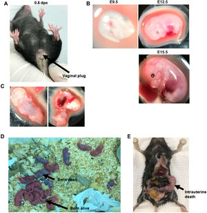 Evaluation of fetal development in Irs1WT/S57X mice progeny. (A) Appearance of the vaginal plug; the arrow indicates the plug. (B) Visualization of fetuses at different gestational ages (E9.5; E12.5; E15.5); 10X magnification. (C) Evidence of fetal absorption in the uterus of a female at 15.5 days of gestation, 10X magnification. (D) Offspring of two females immediately after birth at E18.5. Both births resulted in one intrauterine death, six dead born and 11 born alive litters. (E) Intrauterine death in a postpartum female; the arrow indicates the fetus in the left uterine horn.