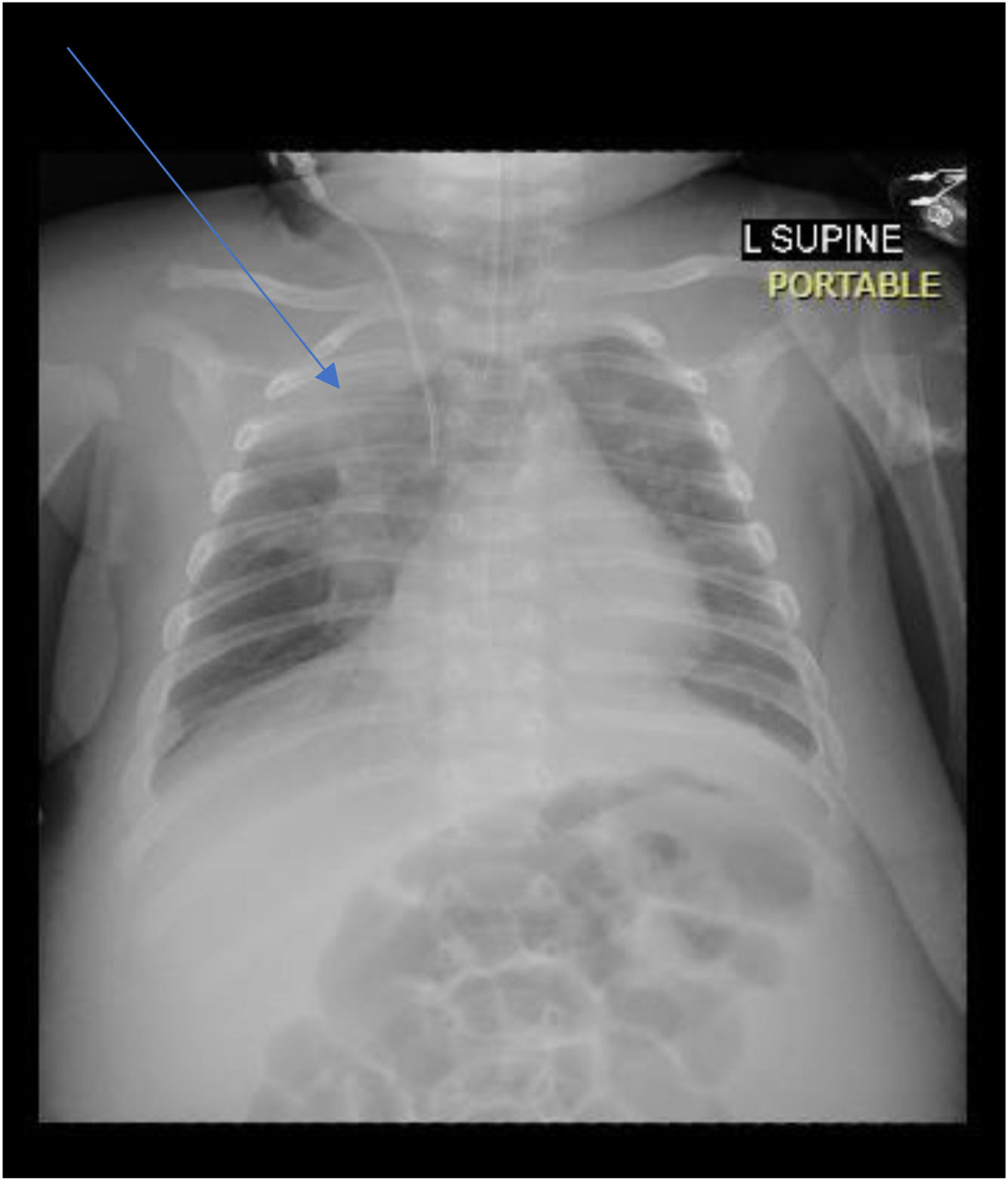 fig0002