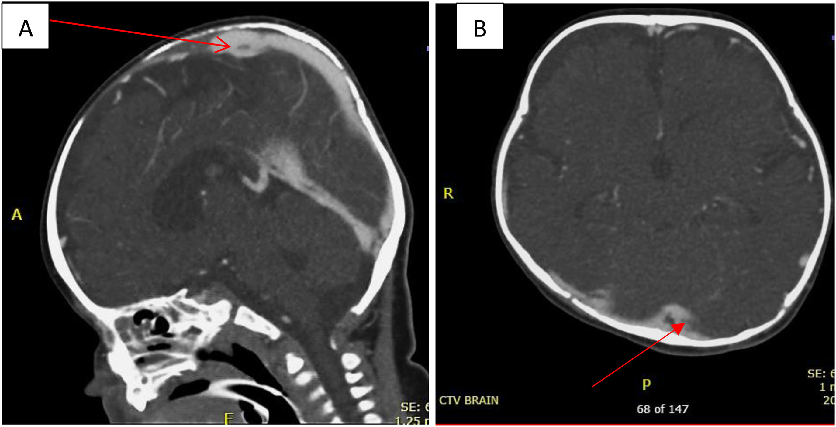 fig0003