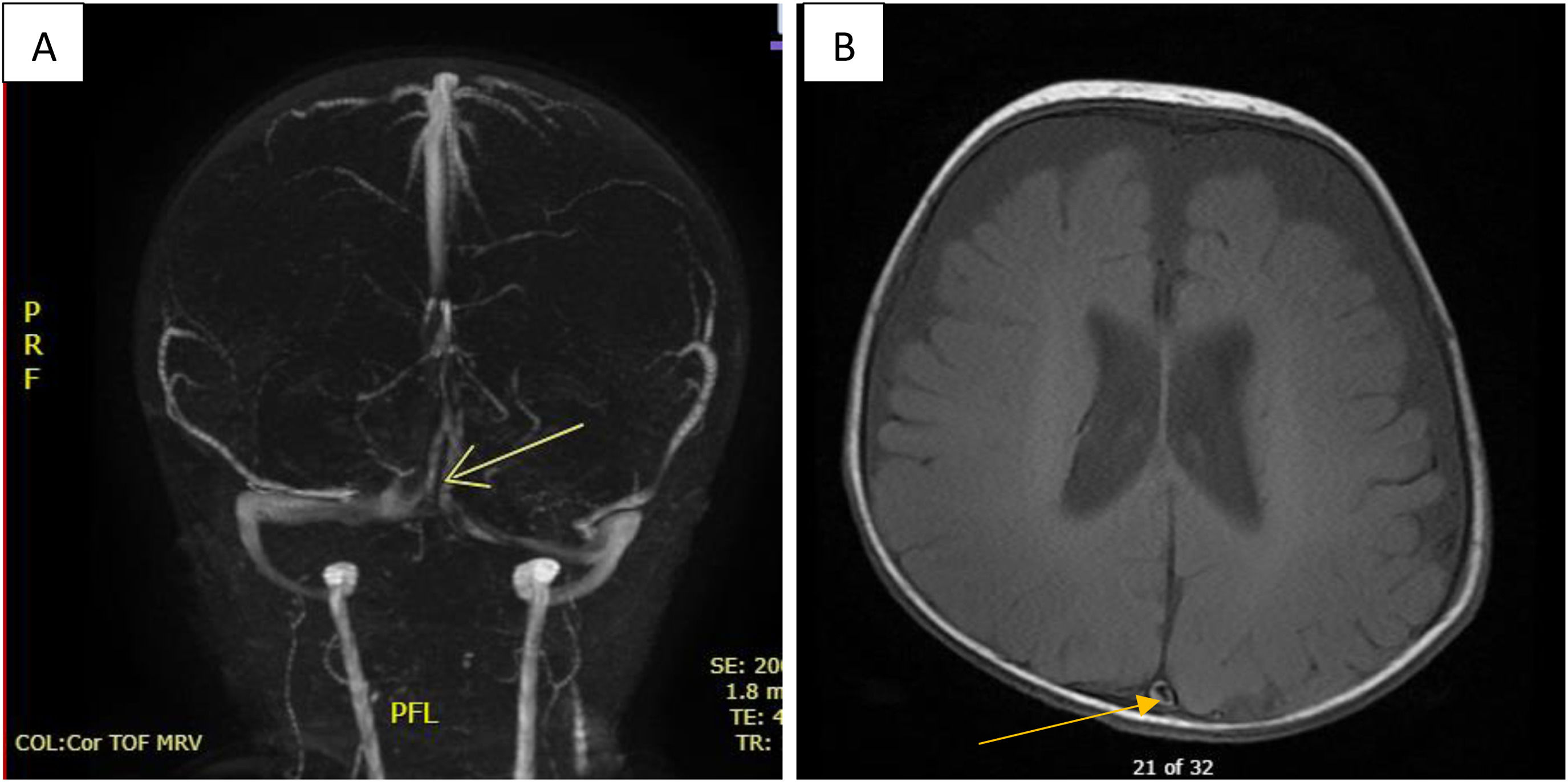 fig0005