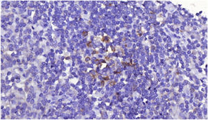 Tissue microarray PD1 spot (2000x).