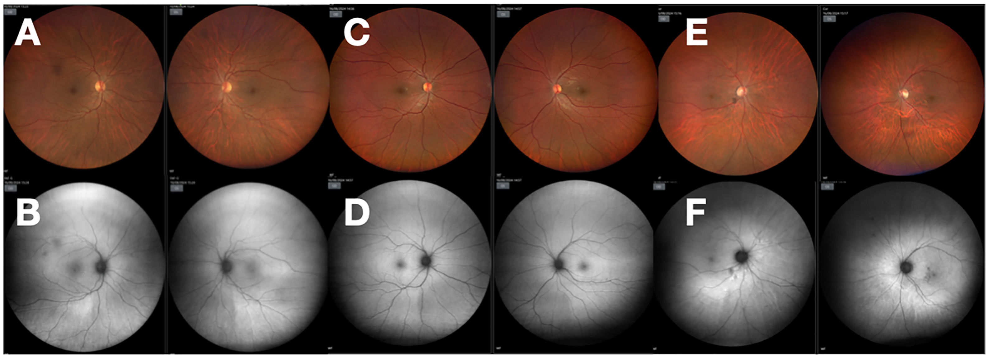 fig0001