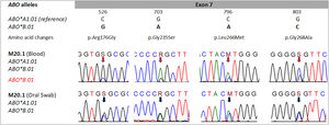 Data from sequencing of the ABO gene. Direct sequencing reveal signals in all nucleotide positions 526, 703, 796, and 803, suggesting heterozygosis in the main alleles ABO*A1.01 and ABO*B.01 in DNA from peripheral blood (red arrows) and DNA from oral swab (black arrows). Distinct signals in the DNA from peripheral blood suggest the presence of mosaicism in the blood donors. The nomenclature S, R, and M follow the IUPAC (International Union of Pure and Applied Chemistry).