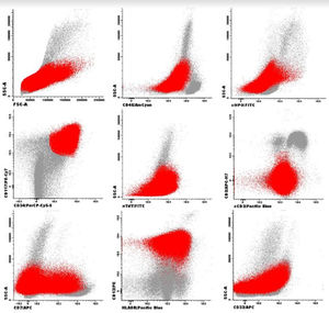 Representative flow cytometric histograms of bone marrow aspirate expression profile of AML cells in red.