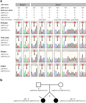 ABO gene sequencing results of proband and her family members. (a) Direct sequencing of the proband and twin sister revealed small peaks (arrows) at all nucleotide positions, indicating heterozygosity for the ABO alleles ABO*A1.02, ABO*B.01, and ABO*O.01.01 in peripheral blood DNA. (b) Hierogram showing the ABO phenotypes and genotypes identified for all family members.