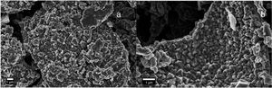 SEM images of the assembled mesostructured cobalt oxide particles. a) Precipitate and b) Supernatant.