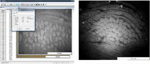 Image Software used (left) and photomicrograph of the textiles under study (right), for determination of the fibers cross-section areas and number of monofilaments in a yarn (UTHSCSA ImageTool software).