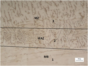AISI 316L heat affected zone (HAZ), melt zone (MZ) and metal of base (MB) for heat input of 1.5kJ/mm. Image obtained with 200× in optical microscope (OM), chemical attack of Beraha reagent.