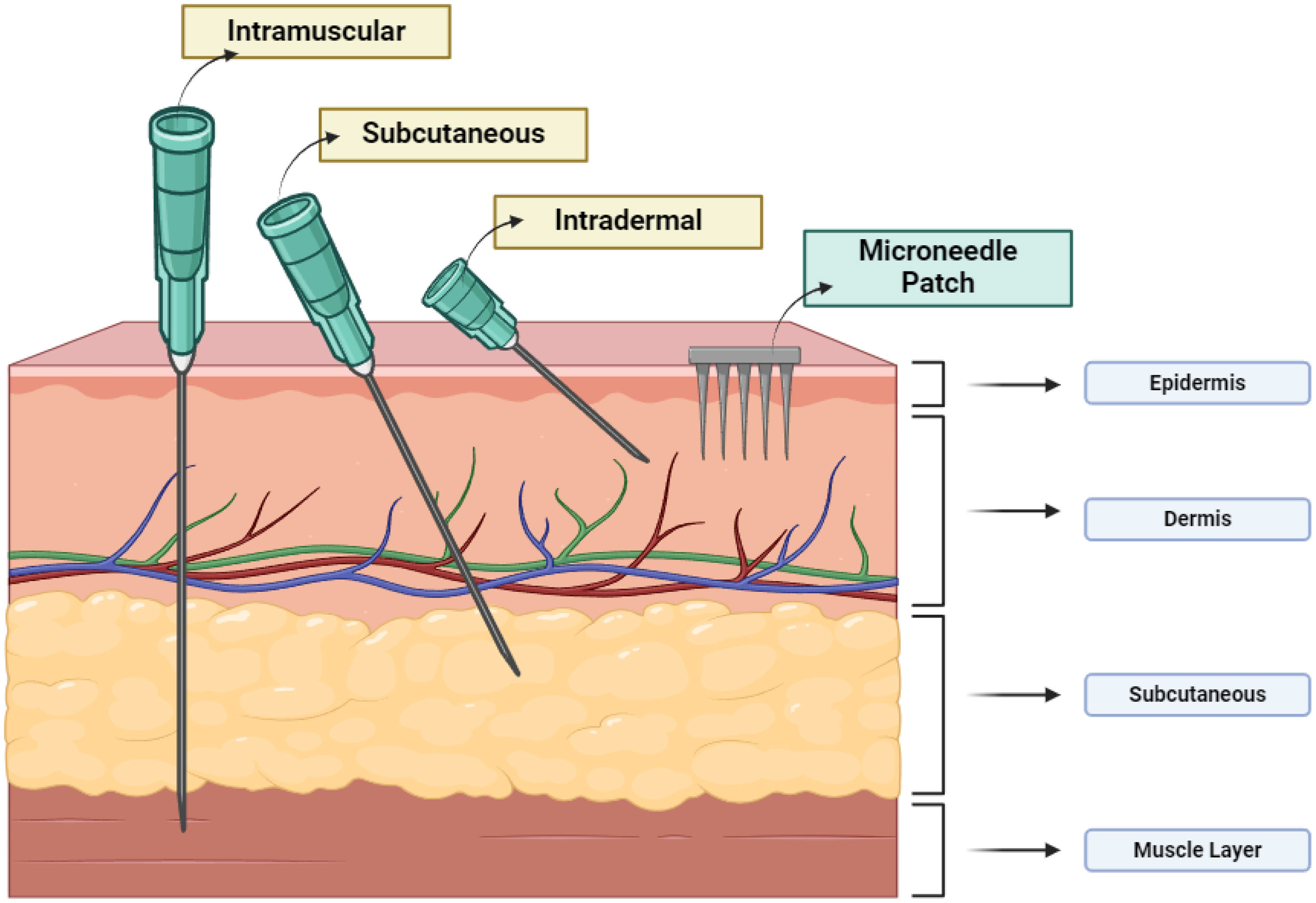 Traditional Injection Enhancing vaccine accessibility and efficacy through microneedle ...